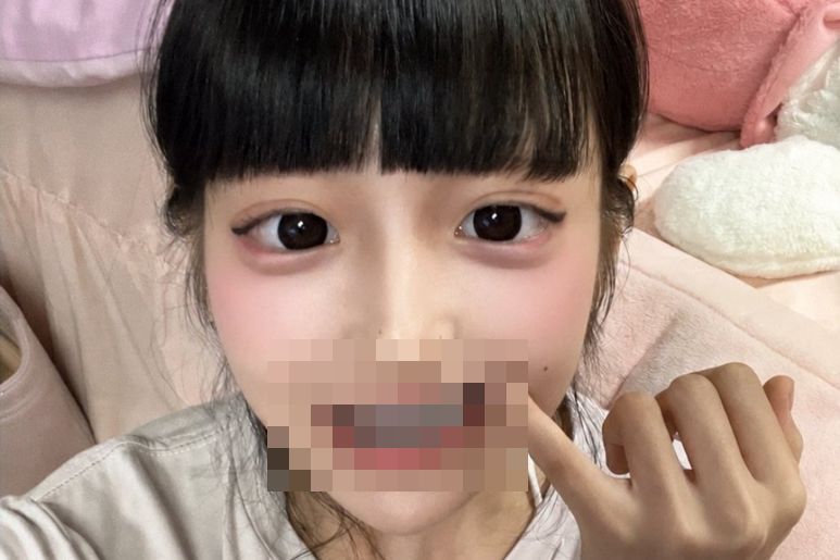 【画像】歯を全部銀歯にした女さん、発見されるｗｗｗｗｗｗｗｗｗｗｗのサムネイル